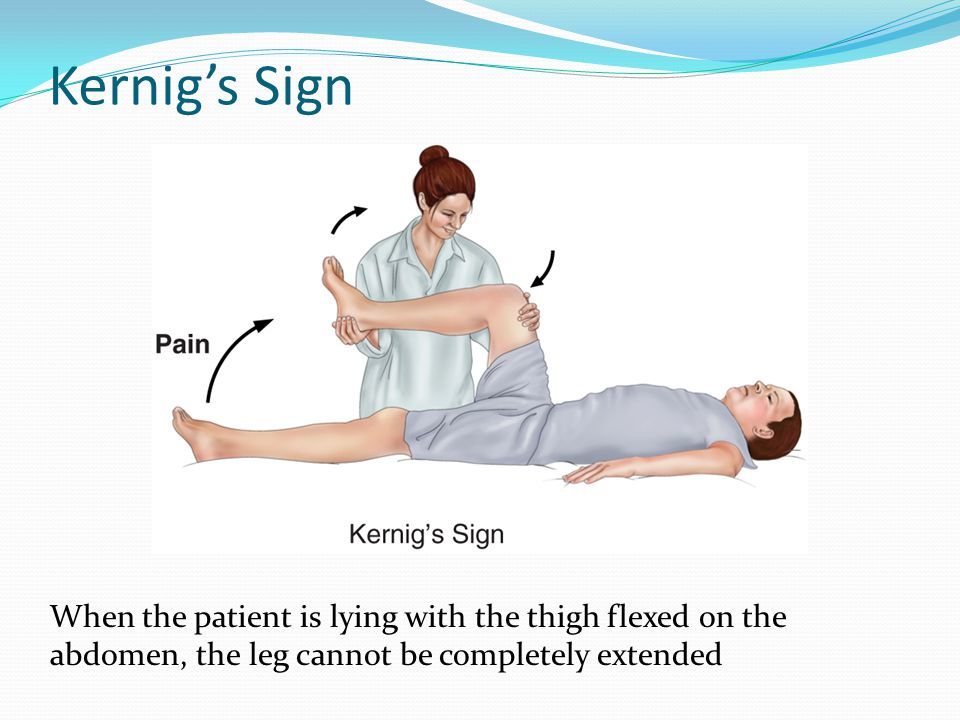 Kernig’s_Sign_When_the_patient_is_lying_with_the_thigh_flexed_on_the_abdomen,_the_leg_cannot_be_completely_extended