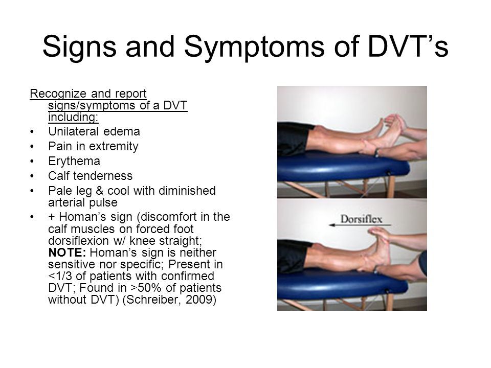 Signs_and_Symptoms_of_DVT’s