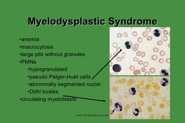 myelodysplastic-syndrome-9-728.jpg